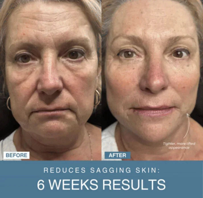 Bloomify™ 7-in-1 LED Anti-Aging/Wrinkle Apparatus