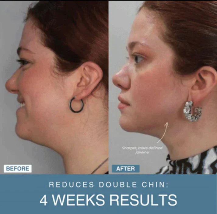 Bloomify™ 7-in-1 LED Anti-Aging/Wrinkle Apparatus