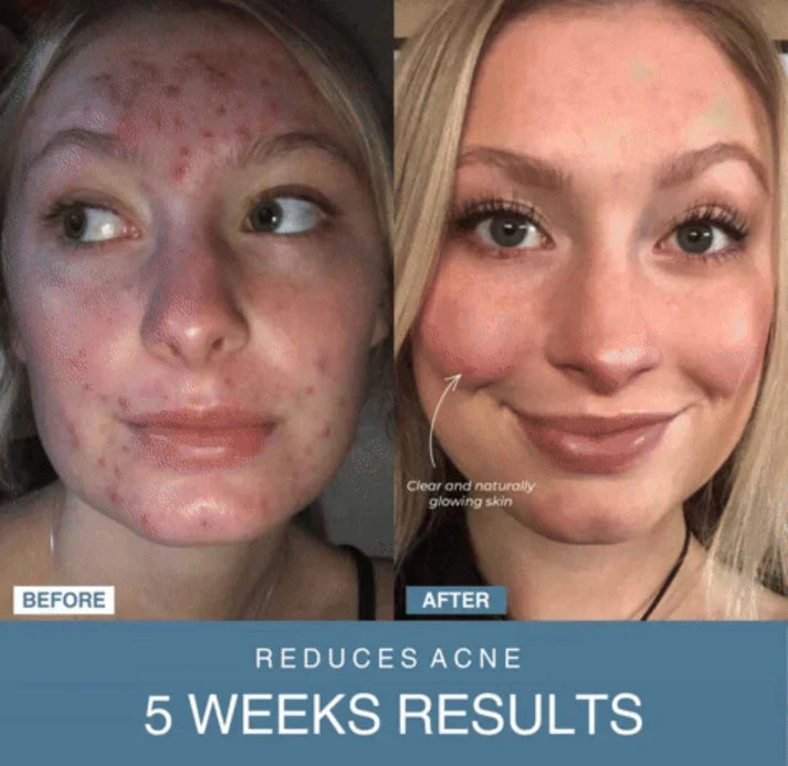 Bloomify™ 7-in-1 LED Anti-Aging/Wrinkle Apparatus